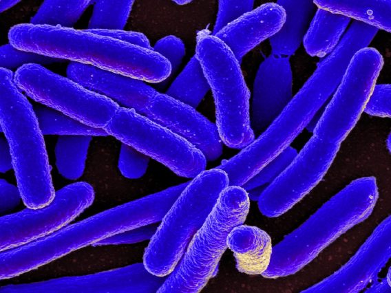 Colorized scanning electron micrograph of Escherichia coli, grown in culture and adhered to a cover slip.